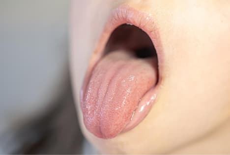 Tongue Diagnosis