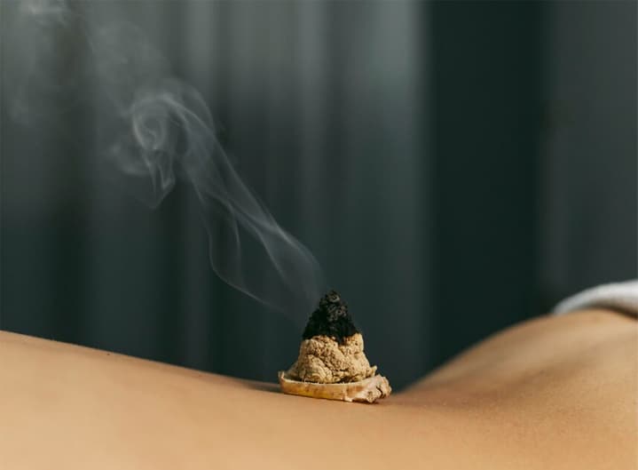 Moxibustion