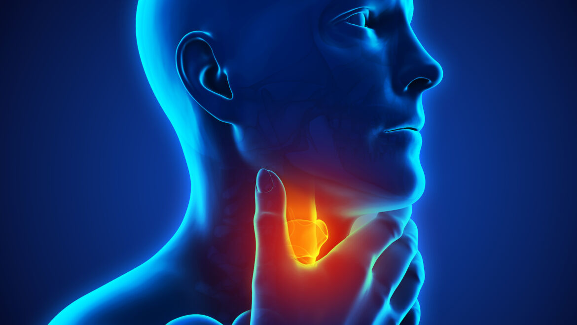 Symptoms of reflux esophagitis